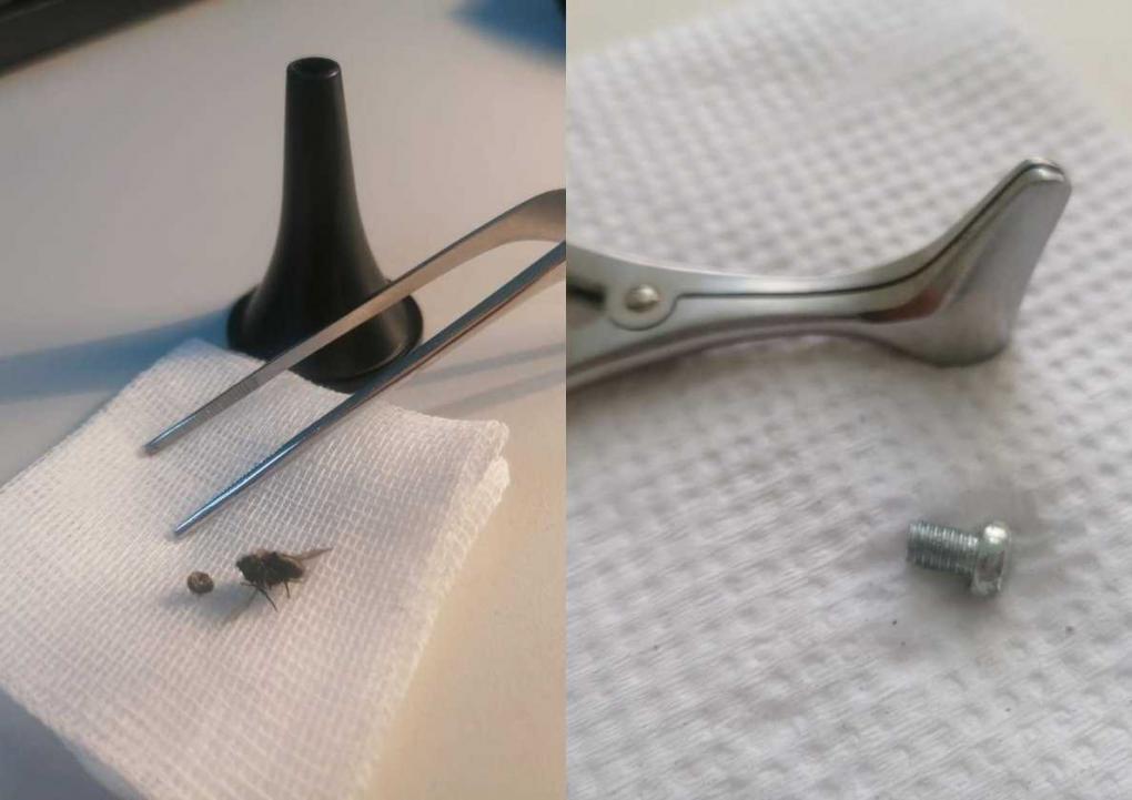 Не только детская проблема: оториноларинголог об извлечении инородных тел