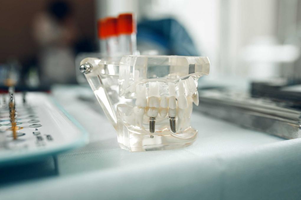 Разрушаем мифы об имплантации зубов