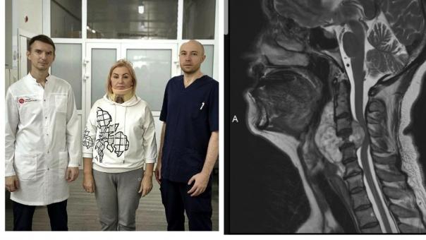 Новосибирские хирурги прооперировали пациентку с опухолью в позвонках