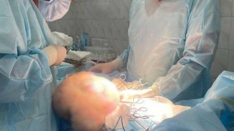 Опухоль весом 9,5 кг удалили у пациентки в Кузбассе