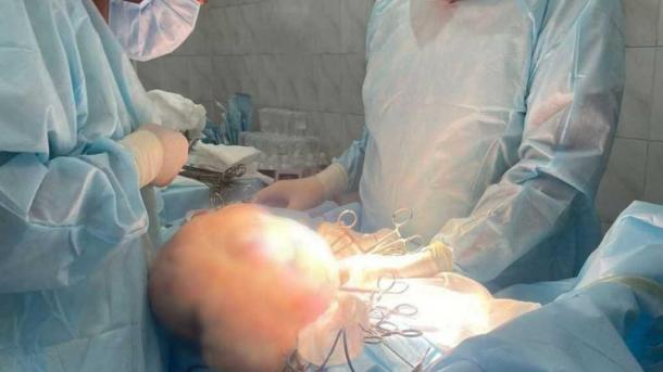 Опухоль весом 9,5 кг удалили у пациентки в Кузбассе