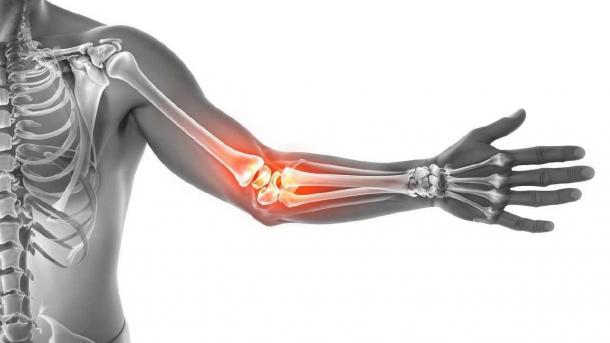 Чувствуете это в руке — смерть уже на пороге. Первые признаки смертельно опасного заболевания