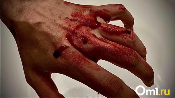 Омич, которому оторвало палец сваей, отсудил 150 тысяч