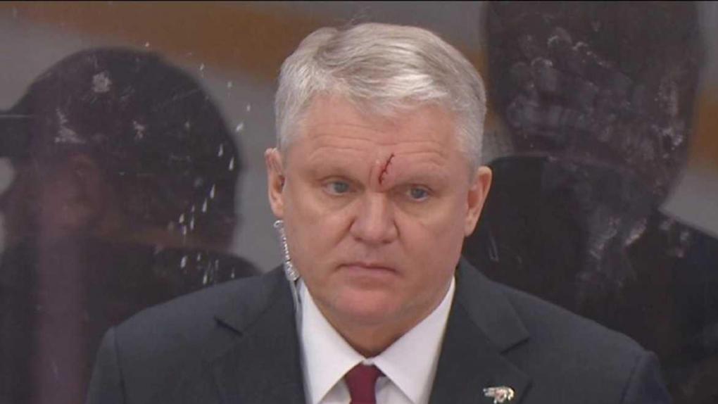 Неприятная травма: тренер «Авангарда» получил повреждение во время матча со «Спартаком»