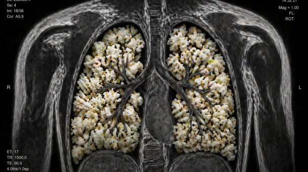 Омичам грозит «попкорновая болезнь», которая распространяется по России