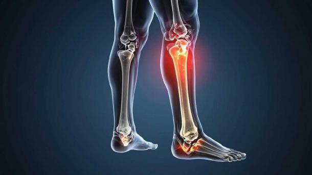 Чувствуете это в ноге — смерть уже на пороге. Первый признак смертельно-опасного заболевания