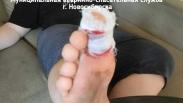 Отдых у воды закончился травмой: спасатели помогли молодому новосибирцу