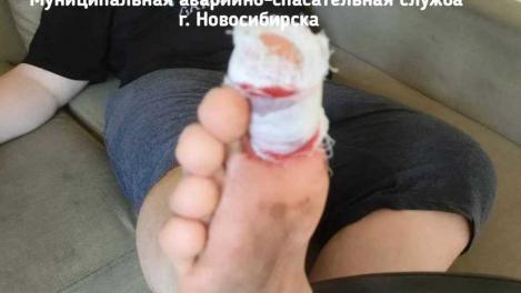 Отдых у воды закончился травмой: спасатели помогли молодому новосибирцу