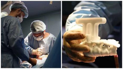 Новосибирские хирурги исправили девочке сложный сколиоз с помощью 3D-шаблона