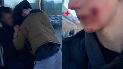 Подросток получил выстрел в лицо при попытке заступиться за младшего брата в Новосибирске