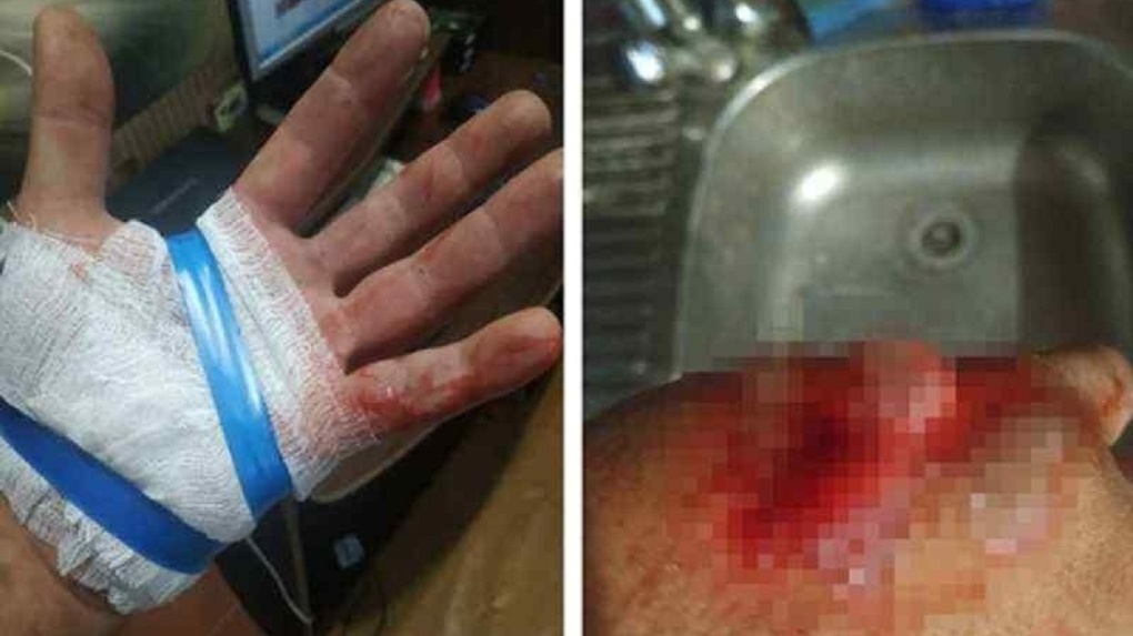 «Я умолял обработать рану»: врачи бросили истекающего кровью новосибирца