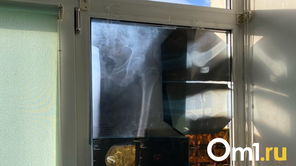 В Новосибирской области выявили районы с самой высокой заболеваемостью туберкулёзом