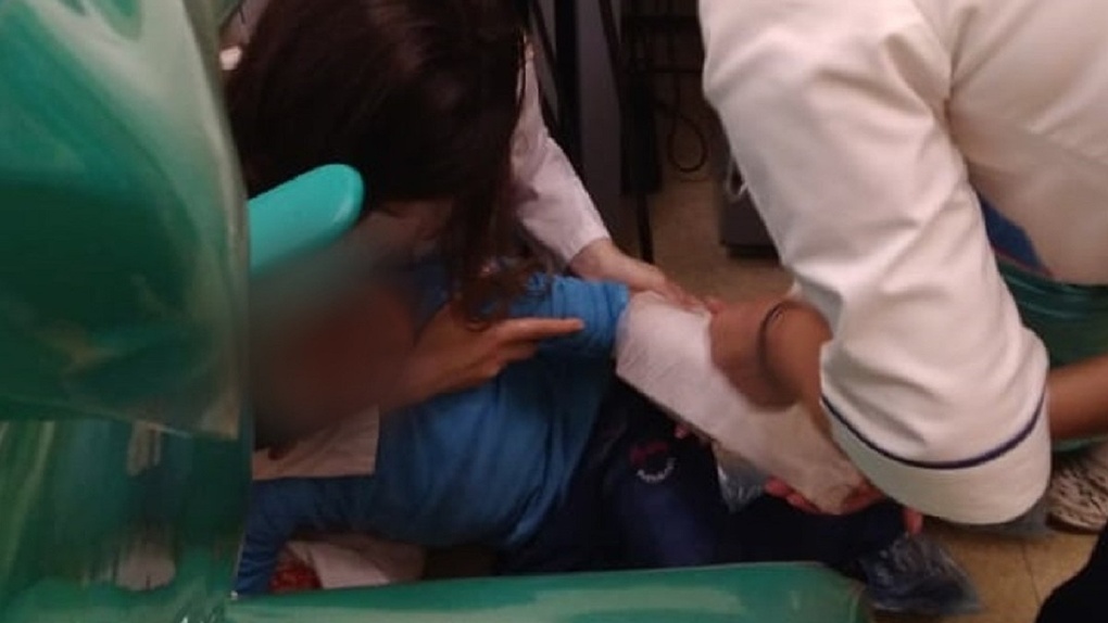 Пятилетнему ребёнку зажало руку стоматологическим креслом в Новосибирске