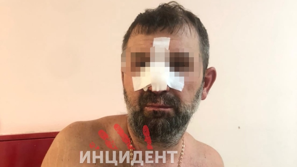 «Кидался на охрану и вырвал турникет»: в Омске охранники разбили нос посетителю во время вечеринки
