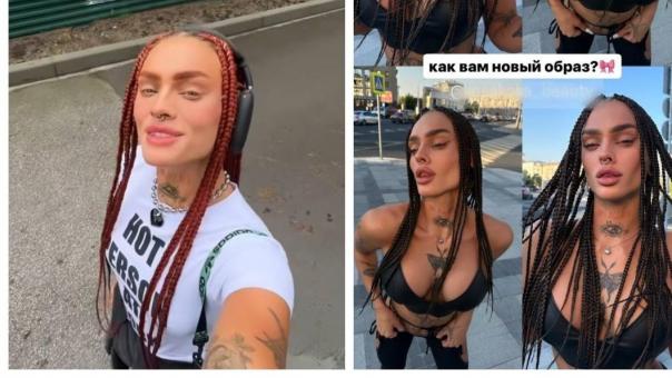 Модель Playboy Кузнецова показала грудь после операции в Новосибирске