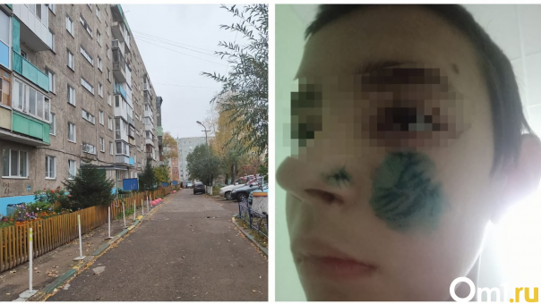 Рассказываем, как восстанавливается ребёнок, на которого год назад напала собака на улице Малиновского