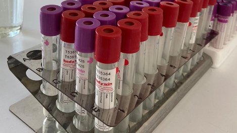 Отделение переливания крови вновь заработало в омской больнице имени Кабанова