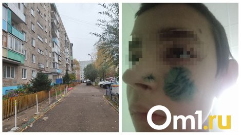 «Хозяйка пса даже не попыталась помочь»: мать покусанного собакой мальчика рассказала о его состоянии
