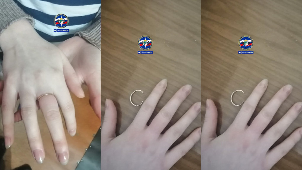 Молодая девушка из Новосибирска обратилась к спасателям, чтобы они помогли снять кольцо с пальца