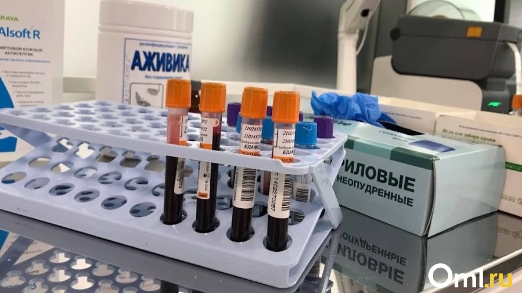 В Омской области за прошлый год зарегистрировано 1 100 новых случаев заражения ВИЧ-инфекцией