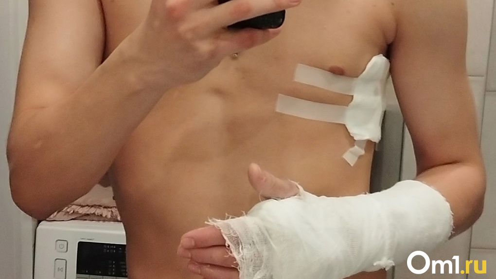 «Нож в сантиметре от позвоночника»: студента из Новосибирска толпой избили и изрезали возле бара