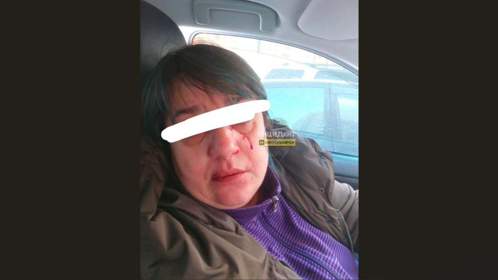 Две женщины избили жительницу Новосибирска за неправильную парковку