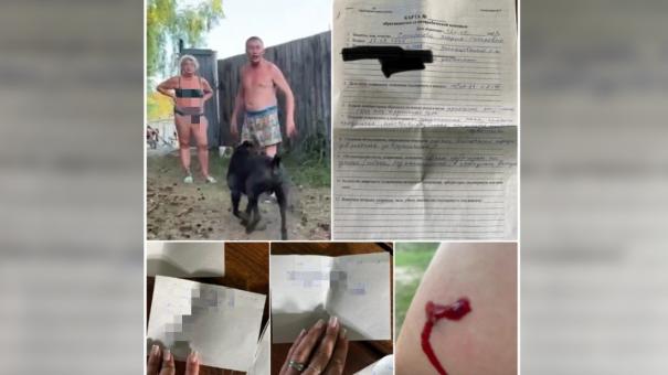 Женщина натравила пса на дачников под Новосибирском