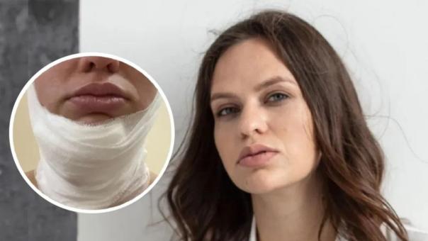 «Я могла не выжить»: актрису из Новосибирска чудом спасли после удаления зуба