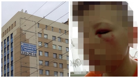 «Ударил в лицо и испинал»: новосибирец жестоко избил школьника во время прогулки