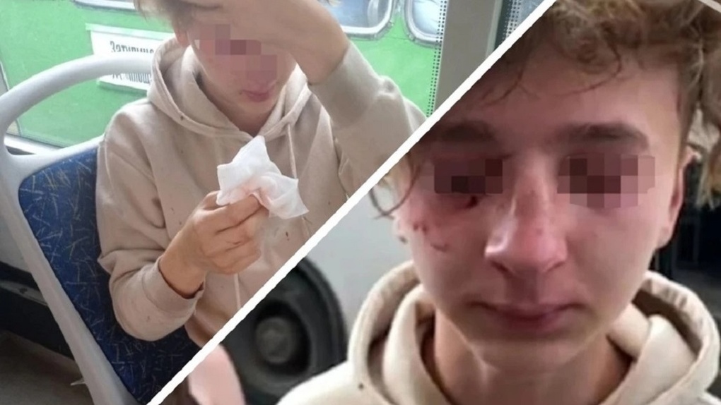 Разбил нос школьнику: уголовное дело возбудили в отношении напавшего на подростка в автобусе новосибирца