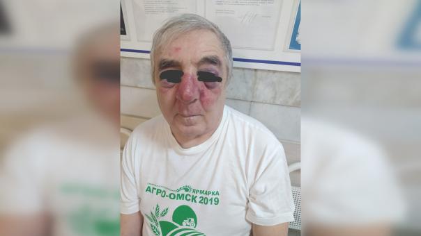 В полицию сдался молодой водитель, который избил пенсионера за нарушение ПДД
