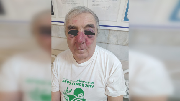 В полицию сдался молодой водитель, который избил пенсионера за нарушение ПДД
