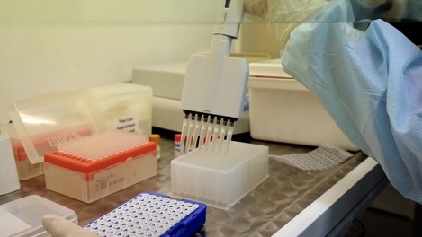 О дефиците реагентов для выявления аллергии заявили в частных лабораториях Новосибирска