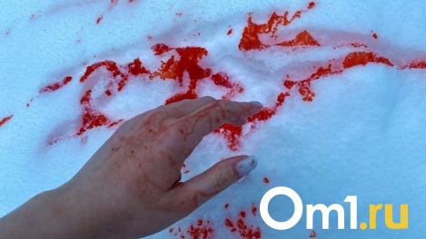 Сломала рёбра и порвала лицо. В День святого Валентина омичка жестоко избила мужчину