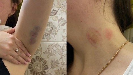 «Меня убивали на глазах у дочери». Омичка в соцсетях рассказала об отношениях с бывшим мужем