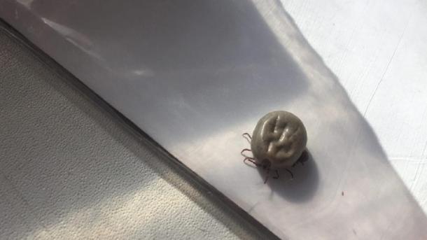 Жители Красноярска массово заразились энцефалитом в этом году