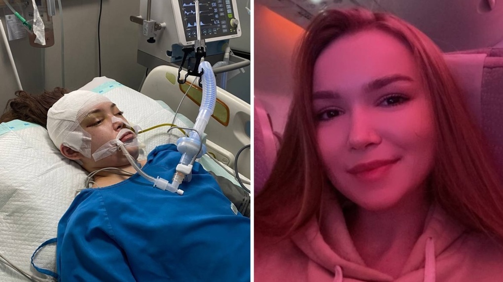 Блогерша из Новосибирска проломила череп в ДТП на острове Бали